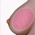 Gel Breasts