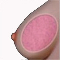 Gel breasts